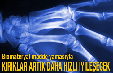 Kırık kemikler artık daha hızlı iyileşecek  